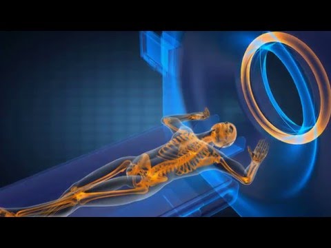 Esercizio trattamento lordosi lombare Per trattare osteocondrosi lombare 2 gradi