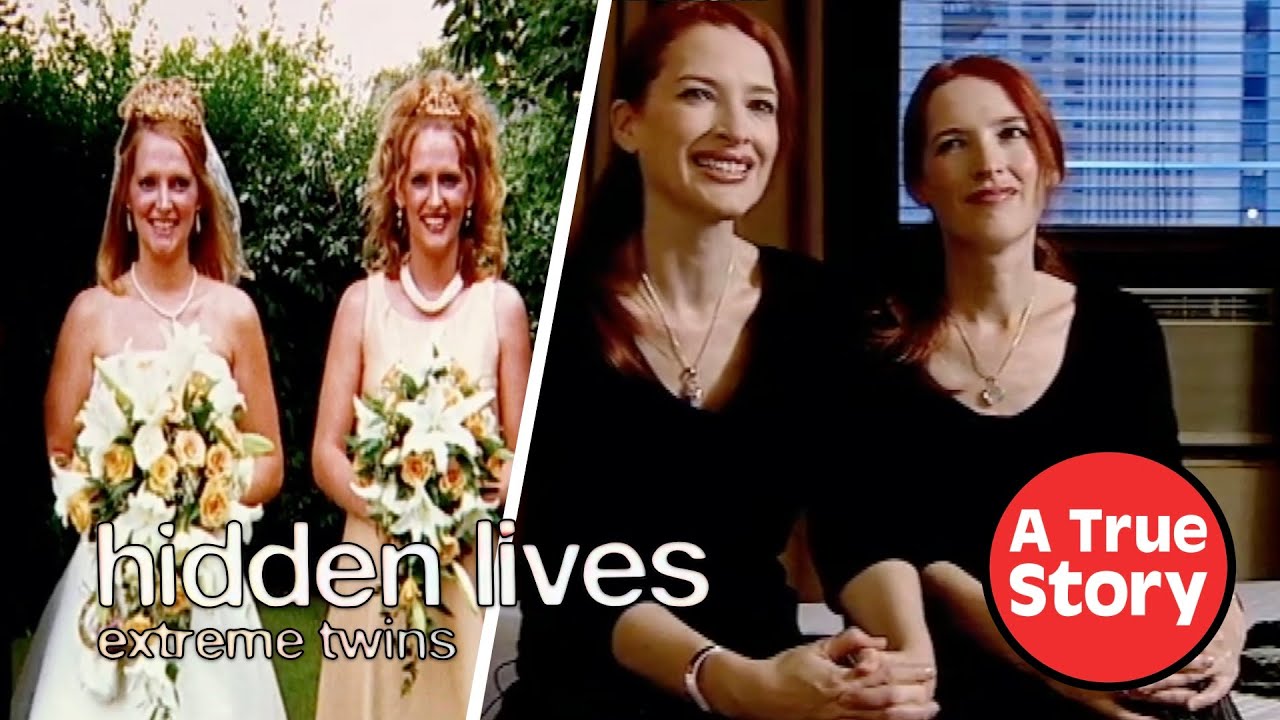 EXTREME Twins that do EVERYTHING Together | A True Story