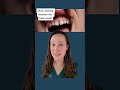 Spaces between baby teeth: normal or no?