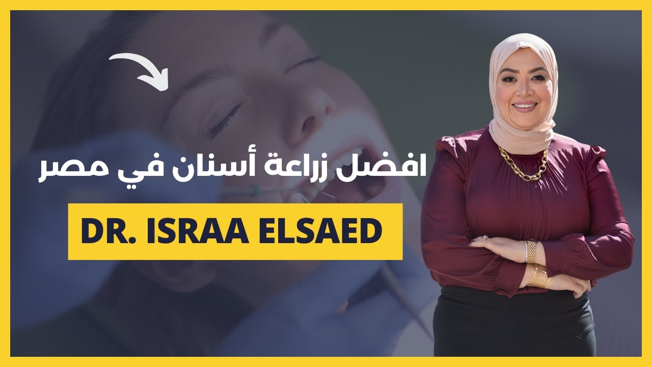 افضل دكتور زراعة اسنان في مصر | انواع الزرعات وافضل التقنيات لزراعة الاسنان