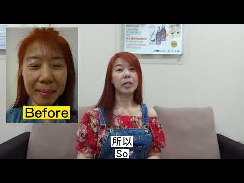 Say Bye-bye to Your Nasolabial Folds👋🏻 