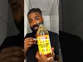 Receding Hairline This Liquid Gold Changes Everything Hair Loss Tips 3 100