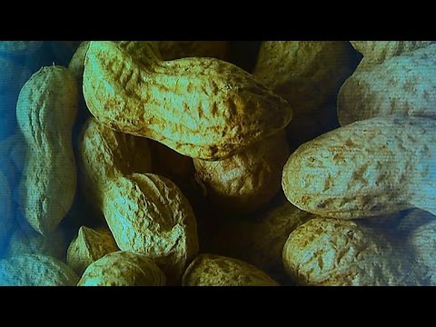 New guidelines to prevent peanut allergies