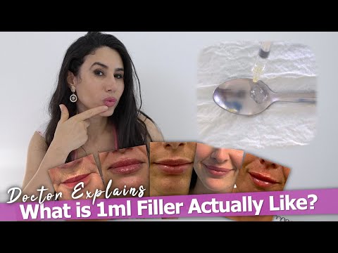 What Does 1ml Lip Filler Actually Look Like? | Doctor Demonstrates on a TEASPOON
