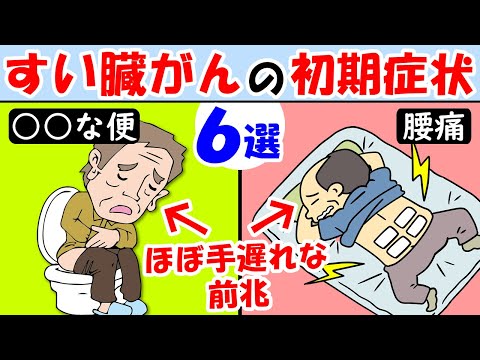 膵臓がんによって引き起こされる12の症状