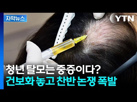 수천억 드는 탈모 치료제 건보 지원?...찬반 폭발한 이유 [자막뉴스] / YTN
