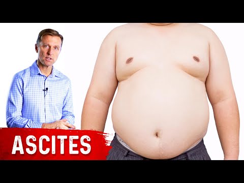 Can Ascites Be Fixed?