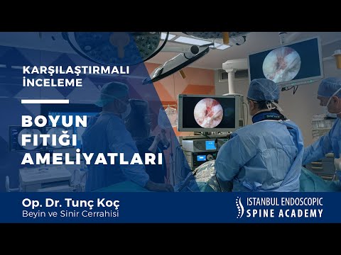 Boyun Fıtığı Ameliyatları Nelerdir? Açık ve Kapalı Ameliyatlar Karşılaştırmalı İnceleme