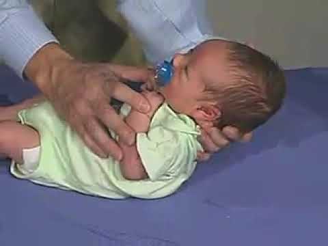 3.23 - Primitive Reflexes, Moro Reflex - Newborn Normal - Infant Clinical Examination(MRCP)