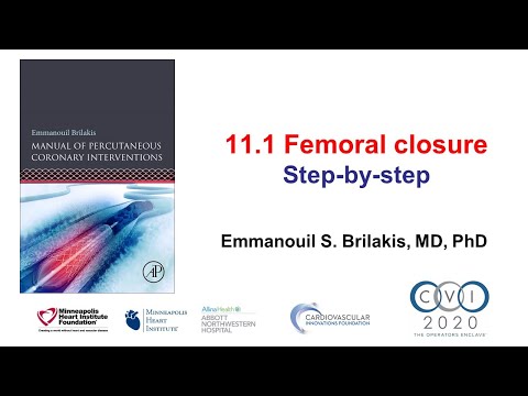11.1 Manual of PCI - Femoral access closure: when and how