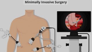 The Future of Surgery Is Insane