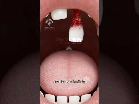 What Happens If You Swallow a Tooth 🦷 #short #viralvideo - Creativelearning3d