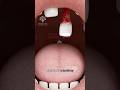 What Happens If You Swallow A Tooth Short Viralvideo Creativelearning3d