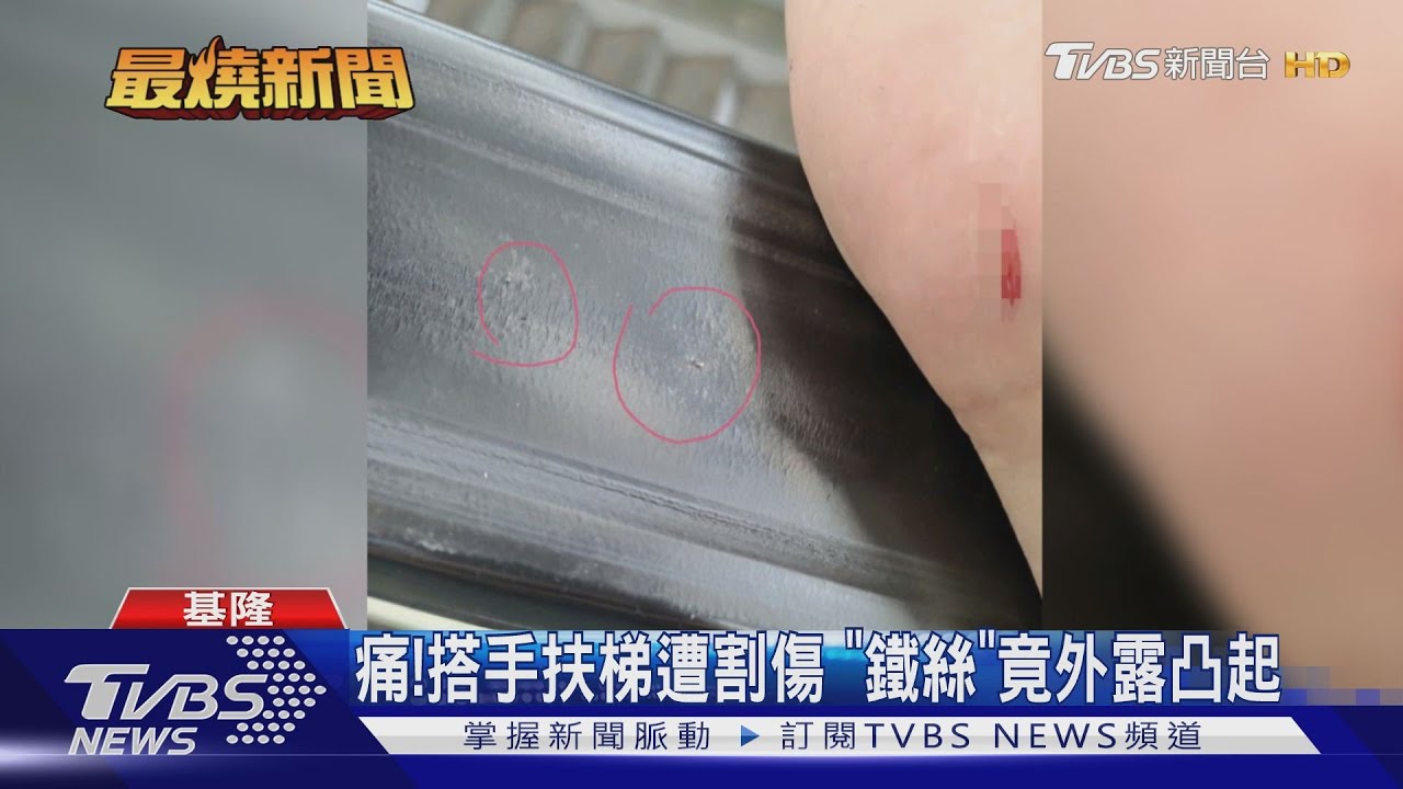 痛!搭手扶梯遭割傷 「鐵絲」竟外露凸起