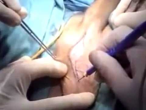 È necessario prendere in cibo per aumentare la potenza Dopo aver smesso quanti recuperare potenza