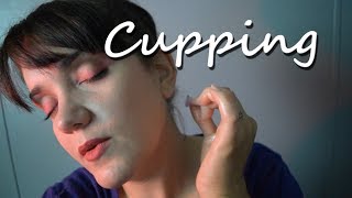 ASMR Neck and Shoulder Cupping - Massage, Sticky Hand Sounds