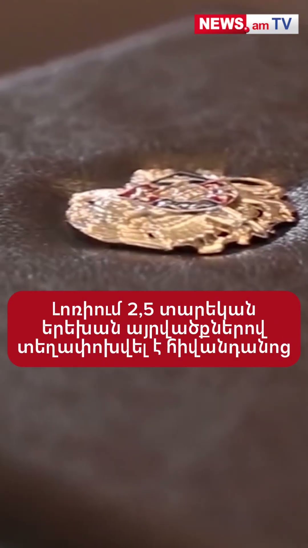 Լոռիում 2,5 տարեկան երեխան այրվածքներով տեղափոխվել է հիվանդանոց