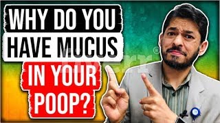 Why Do You Have Mucus In Your Poop || Mucus in Stool IBS || Sameer Islam Videos