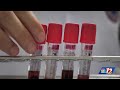 Winston-Salem hematologist explains how blood donations help patients living with blood cancers