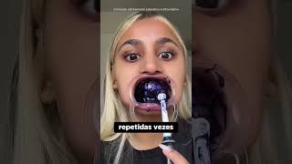 ESSA MENINA CANSOU DE SEUS DENTES AMARELADOS