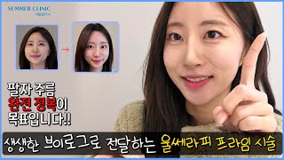팔자주름 완전정복이 목표입니다 | 울쎄라피프라임 브이로그