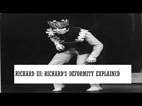 Richard III: Richard's Deformity Explained