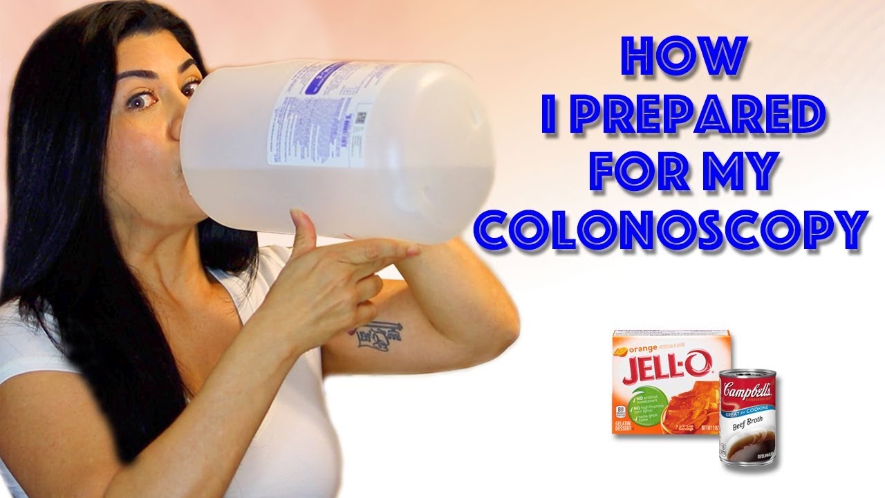 MY COLONOSCOPY PREP & After The Procedure