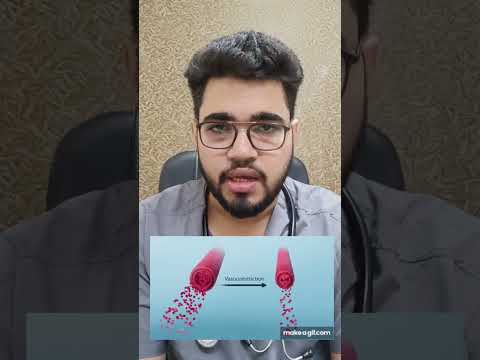 Pain😰 Ice pack or Heating pad ? #doctor #backache #gym #pain #swelling #yoga #kneepain #ice #warm