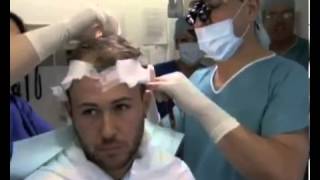 preview picture of video 'Hair Transplant Clinic In Birmingham | 0121 661 4415 | UK Hair Transplant Clinics'