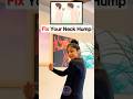 Fix Your Neck Hump With These Simple Exercises