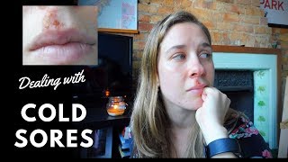 Opening up about Cold Sores (Fever Blisters) | Caths World