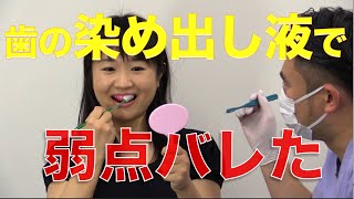 歯の染め出し液で歯みがきの弱点を知る