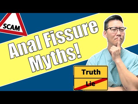 TOP Anal Fissure Myths. The Truth Revealed!