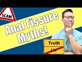 TOP Anal Fissure Myths The Truth Revealed