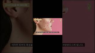 압구정여드름한의원 압구정피부과 하늘체한의원