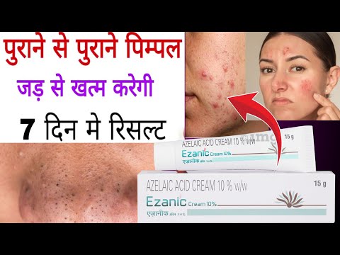 Ezanic 20 Gel intas pharmaceuticals