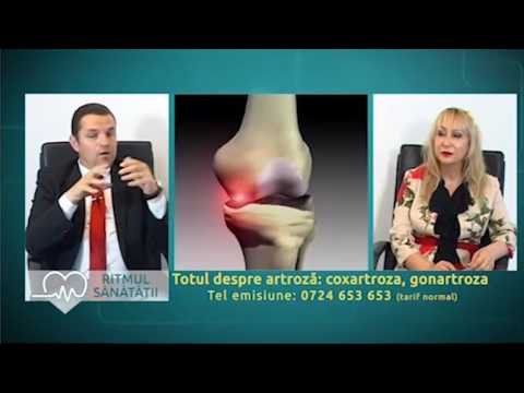 Tratamentul nechirurgical al artrozei genunchiului