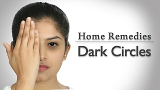 How To Get Rid Of Dark Circles – 3 Ways | Home Remedies With Upasana | Mind Body Soul
