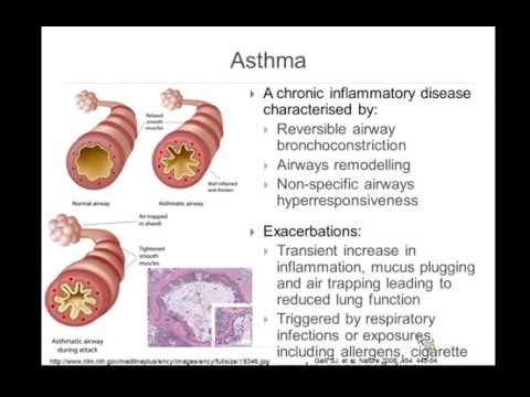 Exposures and Epigenomics: Promises and Pitfalls in the Context of Air Pollution