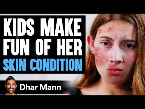 Kids MAKE FUN Of Girl's SKIN CONDITION, What Happens Is Shocking | Dhar Mann