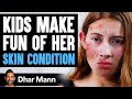 Kids MAKE FUN Of Girl's SKIN CONDITION, What Happens Is Shocking | Dhar Mann