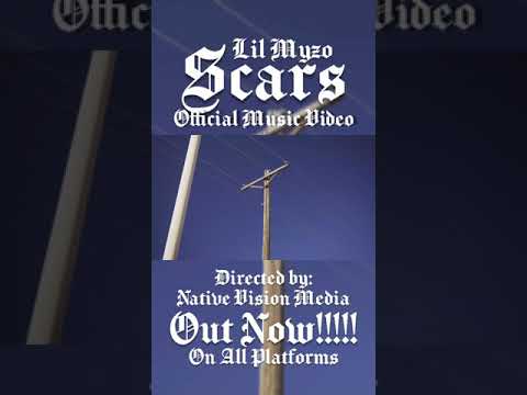 Lil Myzo - Scars Official Music Video Out Now on @Native Vision Media 's YouTube. 😈🔥