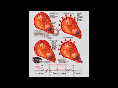 Understanding Uterine Contractions And HIE