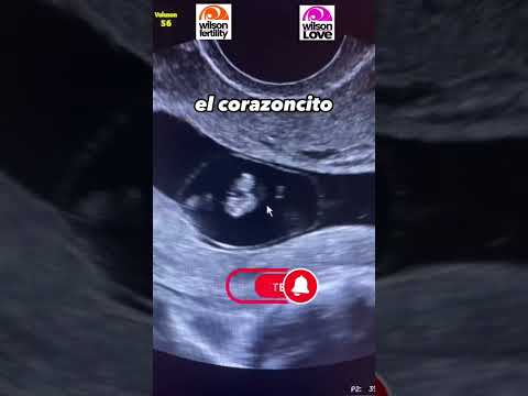 What does an 8-week pregnancy look like?