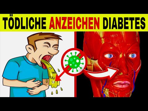 7 TÖDLICHE ANZEICHEN von DIABETES, die du nicht ignorieren darfst (diabetische Ketoazidose)