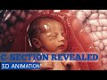 C-SECTION: Real-Life 3D Animation of Birth