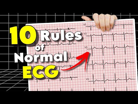 ECG Interpretation: 10 Rules of Normal ECG (Remastered)