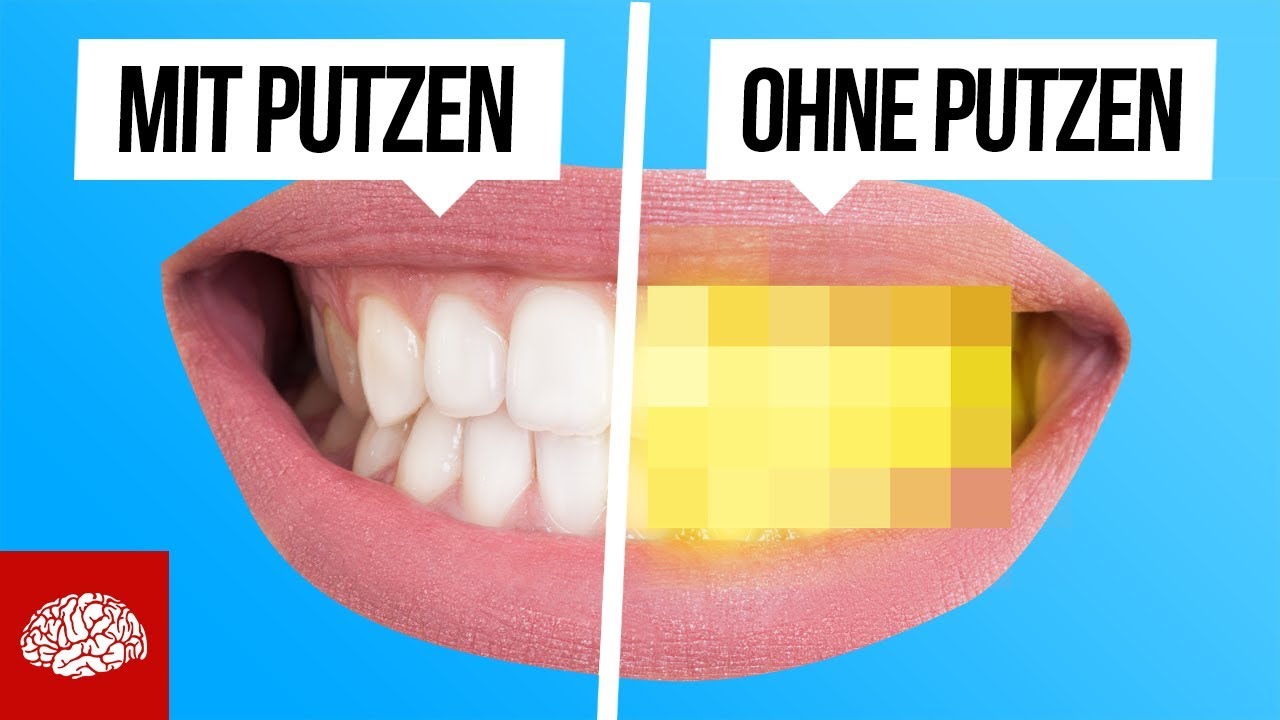 Was passiert, wenn du nie wieder deine Zähne putzt?