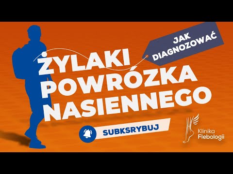 Żylaki powrózka nasiennego – jak zdiagnozować?