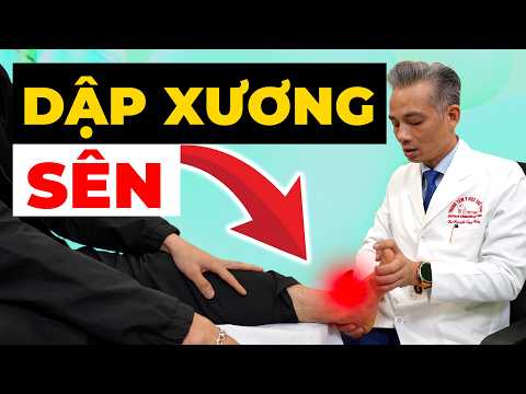 Dập Xương Sên Có Đá Bóng Được Không? Sai Lầm Khiến Tái Chấn Thương!